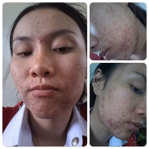 Tắm 3 lần/tuần bằng hỗn hợp này, da nàng 9X trắng đẹp không tỳ vết Tam 3 lan/tuan bang hon hop nay, da nang 9X trang dep khong ty vet