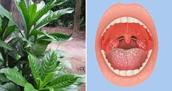 6 loại lá dân dã trị viêm họng nhạy hơn kháng sinh - Hình 2 6 loai la dan da tri viem hong nhay hon khang sinh-Hinh-2
