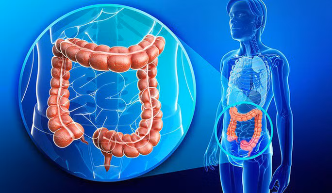 Phát hiện ung thư đại trực tràng sớm nhờ công nghệ mới Phat hien ung thu dai truc trang som nho cong nghe moi