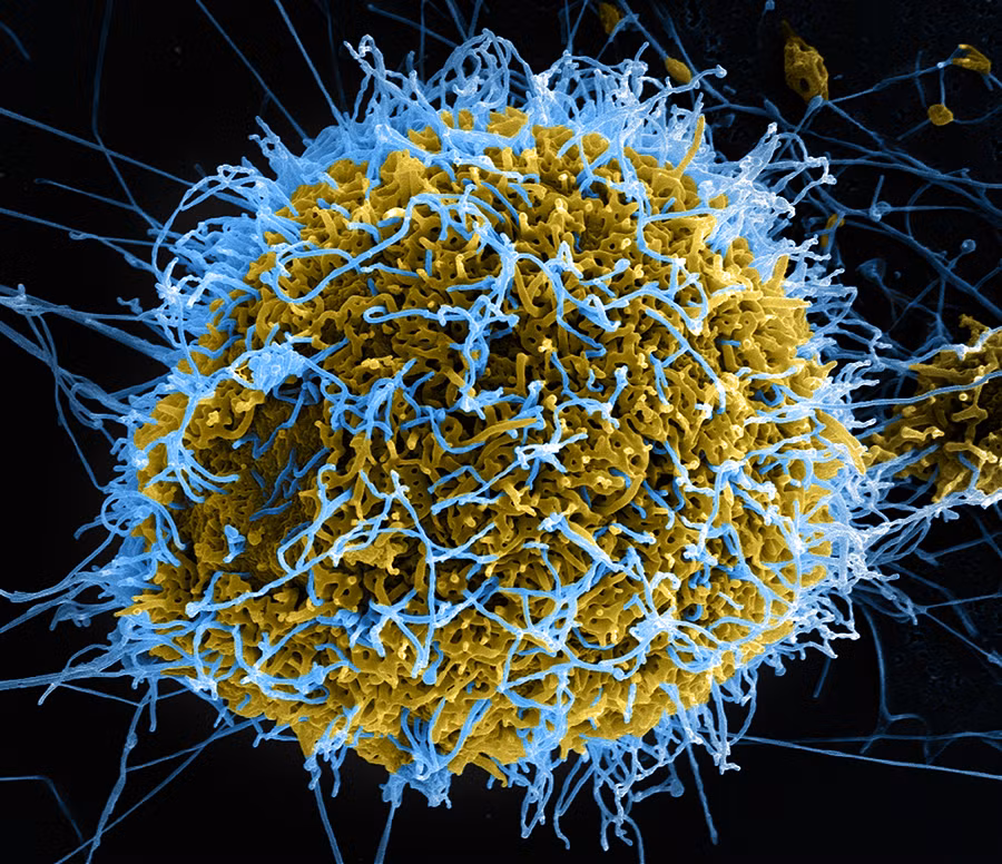 2. Virus Ebola: Có 5 chủng virus Ebola, trong đó chủng Ebola Zaire là nguy hiểm nhất, với khả năng gây tử vong lên tới 90%. Loài cáo bay được cho là mang virus này tới các thành phố ở Tây Phi, gây ra những đợt bùng phát kinh hoàng.