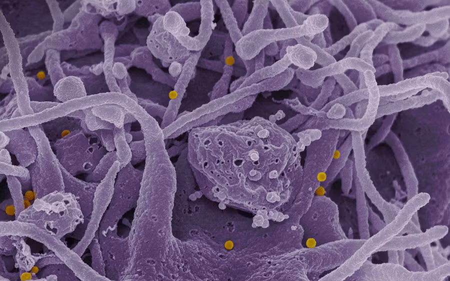 7. Virus sốt Crimea-Congo: Virus này lây lan qua động vật trung gian là các con Pet, với các triệu chứng xuất huyết ở mặt, miệng và họng trong những ngày đầu nhiễm trùng. Nó tương tự như virus Ebola và Marburg về quá trình phát triển bệnh.
