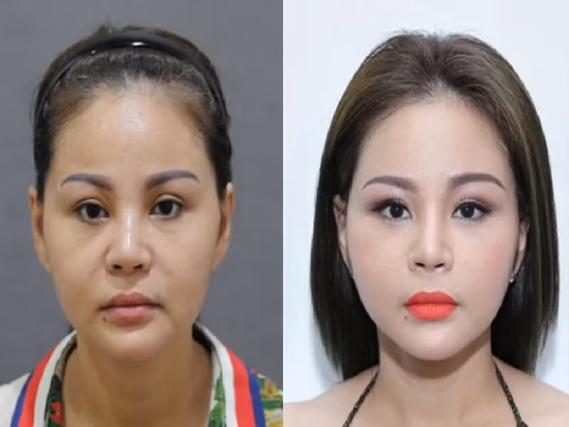 Bị nhiều cư dân mạng chê nhan sắc sau dao kéo, Lê Giang cho biết, cô vui vẻ đón nhận. Theo Lê Giang, cô phẫu thuật thẩm mỹ là để bản thân hoàn hảo hơn chứ không phải đã đẹp rồi nhưng vẫn cố tình đi chỉnh sửa. Ảnh: Saostar.