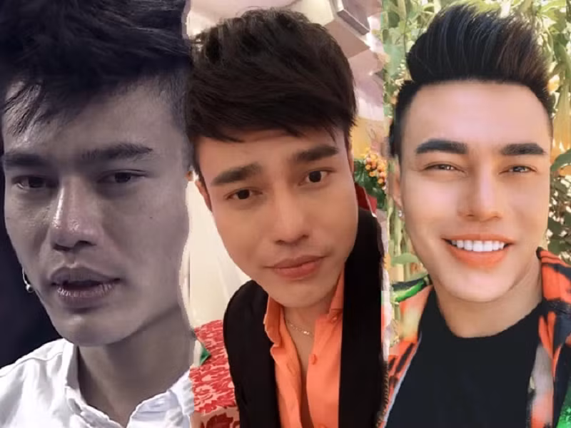 Ngoài sửa mũi, nam diễn viên hài còn thêu chân mày, nhấn mí mở tròng, tẩy môi thâm, làm răng, tiêm mặt, gọt hàm. Lê Dương Bảo Lâm thừa nhận, anh có sở thích mỗi năm làm một bộ răng sứ mới. Ảnh: Phụ Nữ Việt Nam.