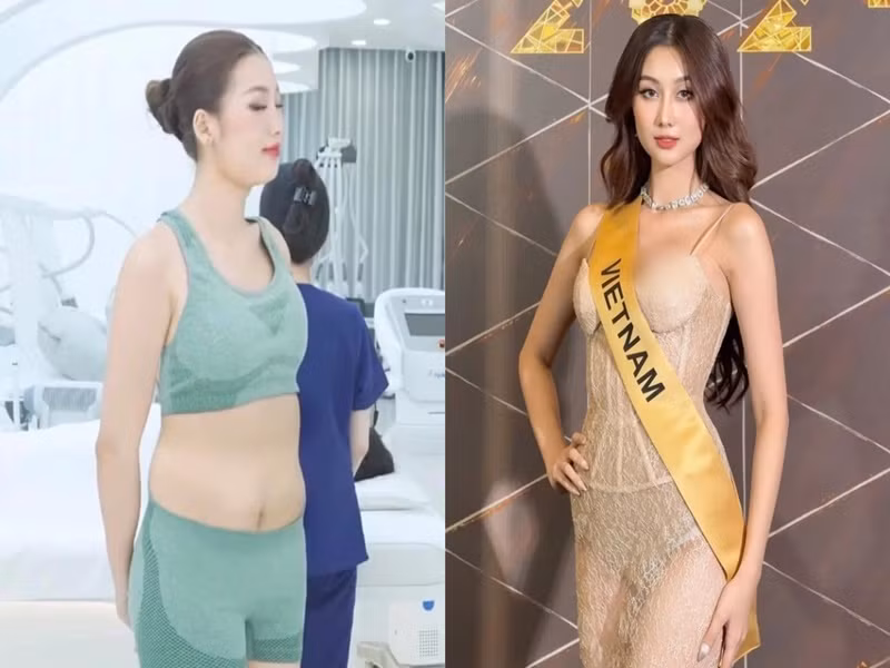 Mới đây, cư dân mạng lan truyền hình ảnh được cho là Hoa hậu Quế Anh đi hút mỡ bụng. Thực tế, nàng hậu bị cắt ghép hình ảnh để trục lợi. Ảnh: Saostar.