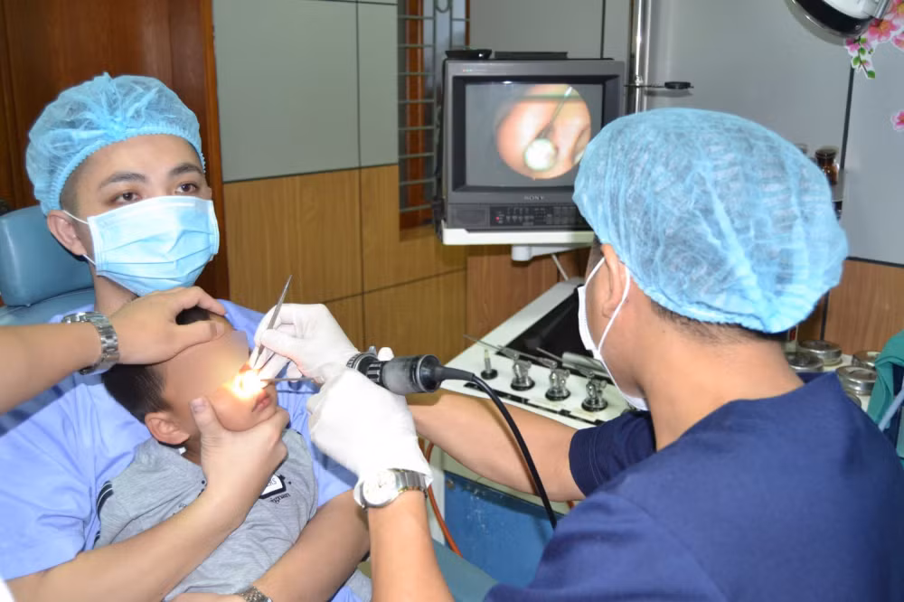 Vien bi nhua nam sau trong hoc mui cua be trai 4 tuoi