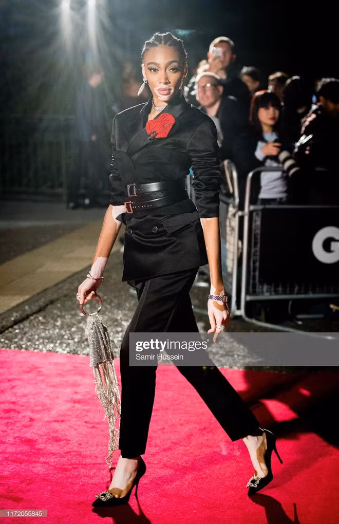 Người mẫu bạch biến Winnie Harlow chọn suit nhấn nhá họa tiết trái tim trên ngực áo, tết tóc cầu kỳ.