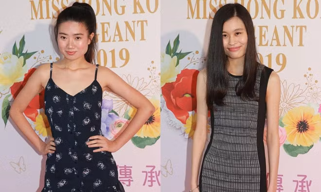 Một cô gái có tên là Angelica, 25 tuổi, có chiếc cằm nhọn nhìn thiếu tự nhiên. Nhưng cô khẳng định mình không trải qua chỉnh sửa nhan sắc.