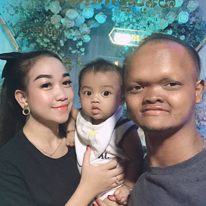 Sau khi đăng ảnh con trai, cặp đôi "đũa lệch" khiến nhiều người ngỡ ngàng bởi đứa trẻ vô cùng kháu khỉnh, đáng yêu. Nhiều người nhận xét, em bé có đôi mắt to tròn giống bố, gương mặt bầu bĩnh giống mẹ.