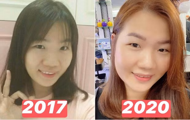 Gương mặt của Thúy Kiều gần như "lột xác", cô nàng xinh xắn và tròn trịa hơn hẳn. Làn da của cô nàng cũng mịn màng, trắng trẻo hồng hào hơn.