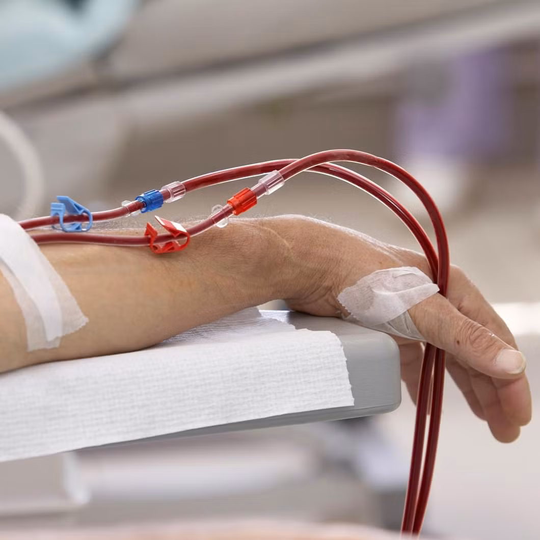 Cũng giống như chuột rút, nhức đầu khi chạy thận nhân tạo cũng là vấn đề thường gặp nhưng chưa rõ nguyên nhân. Ảnh: ngaydautien.