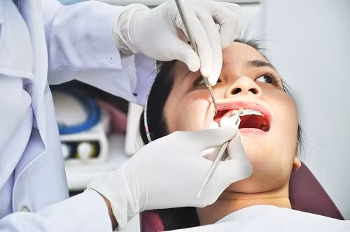 Trong vài ngày đầu sau nhổ răng khôn, bạn nên ăn đồ mềm và dễ tiêu hóa. Nhất là trong 2 ngày đầu tiên, bạn không nên ăn thức ăn quá cứng, quá mặn, đồ ngọt, chua, cay. Ảnh: vietbao.