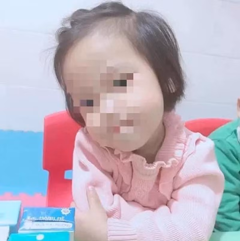 Toàn cảnh vụ bé gái 3 tuổi tử vong do bị đóng đinh vào đầu - Hình 2 Toan canh vu be gai 3 tuoi tu vong do bi dong dinh vao dau-Hinh-2