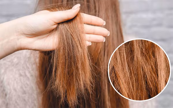 Lưu ý, bạn chỉ nên thi thoảng dùng nước súc miệng trị gàu. Tuyệt đối không dùng hàng ngày bởi thành phần nước súc miệng có thể khiến tóc bị khô, chẻ ngọn.