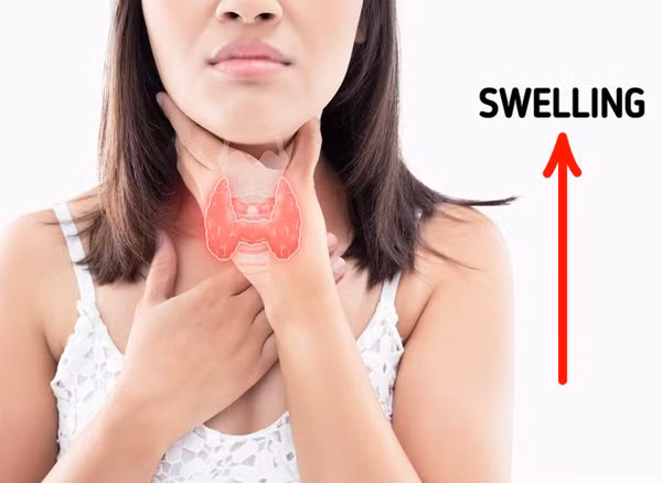 Kiểm soát tuyến giáp: Mặt sưng phù có thể thể do tuyến giáp hoạt động kém. Lúc này, cơ thể sẽ trở nên mệt mỏi, tăng cân và táo bón. Tốt nhất, bạn nên đi khám để phát hiện và có cách điều trị sớm. 
