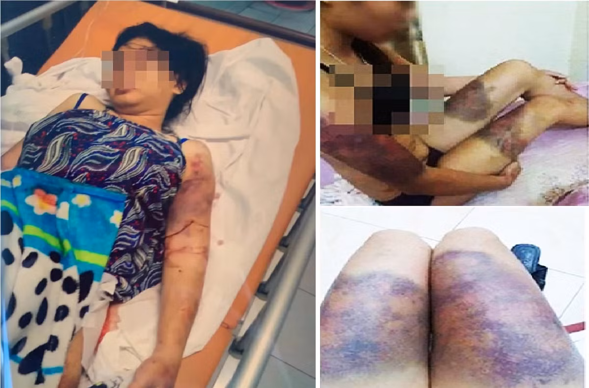 Suc khoe thai phu bi tra tan da man den say thai gio ra sao?