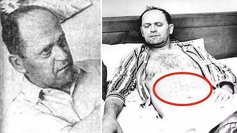 Bí ẩn cuộc chạm trán với UFO khiến người đàn ông bị bỏng Bi an cuoc cham tran voi UFO khien nguoi dan ong bi bong
