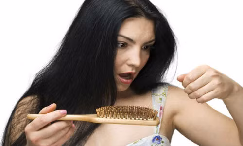 Tóc rụng nhiều gây mất thẩm mỹ.