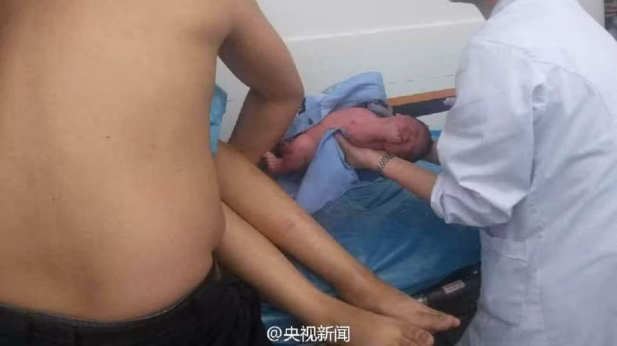 Xu ChunPeng đã đỡ đẻ thành công. (Nguồn: CCTV).