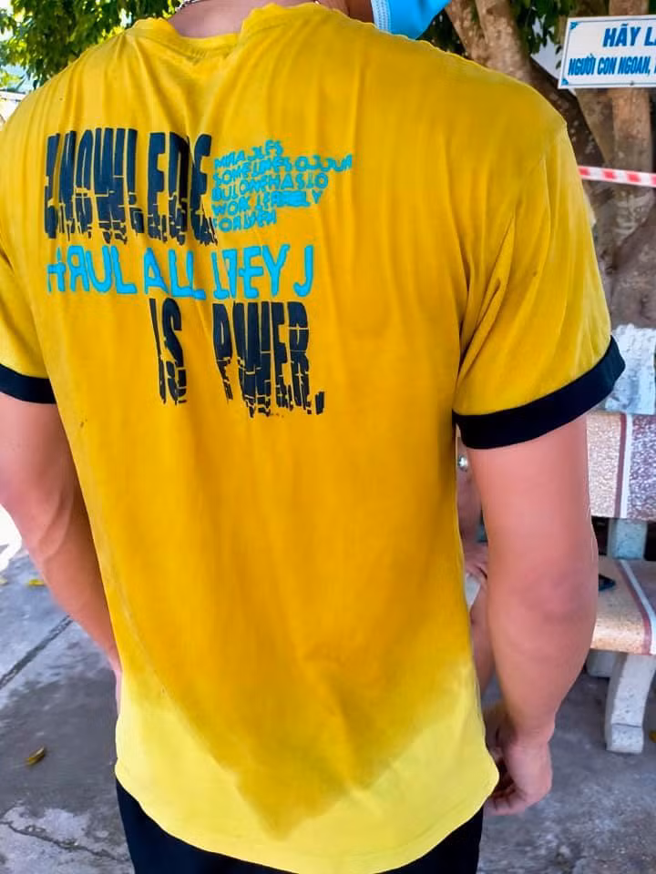 Đặc biệt, cơ thể của hầu hết các cán bộ y tế đều ướt đẫm mồ hôi, do phải mặc đồ bảo hộ suốt cả ngày và làm việc dưới thời tiết nóng gay gắt.