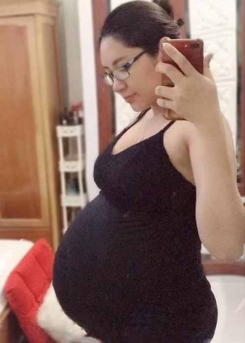 Vì mang song thai nên Thu Thảo bị rạn da khá nhiều.
