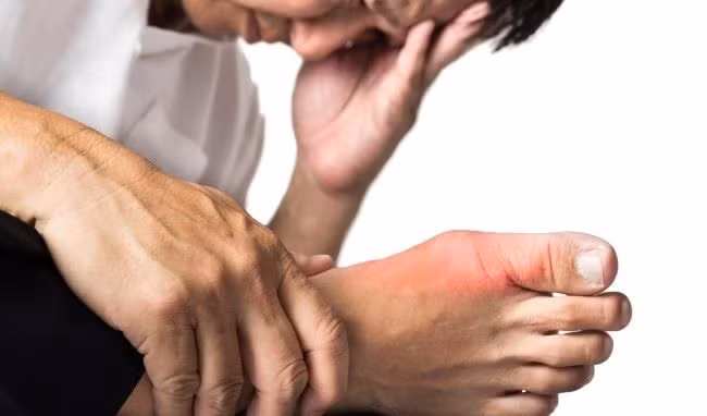 Co 3 dau hieu nay khi di ve sinh, 10 nguoi thi 9 nguoi mac benh gut