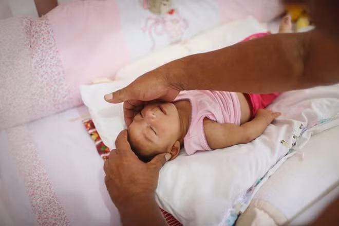 Virus Zika ăn não có thể xâm nhập Việt Nam dịp Tết - Hình 2 Virus Zika an nao co the xam nhap Viet Nam dip Tet-Hinh-2