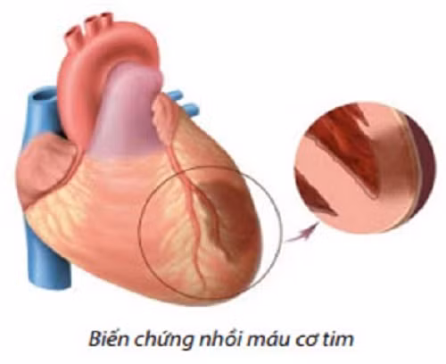 Huyet ap cao co nguy hiem khong?