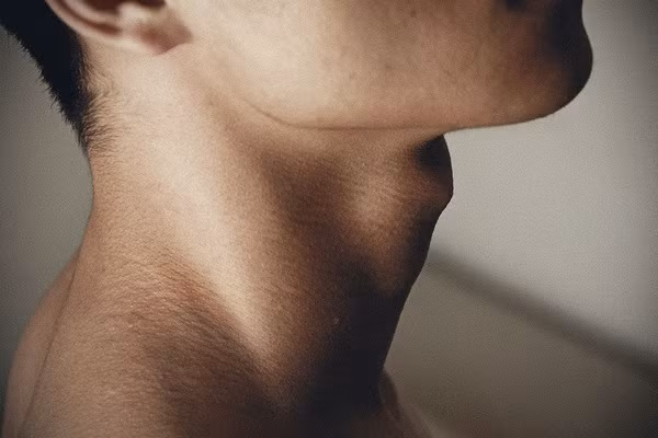  Yết hầu: Phụ nữ ngước thẳng cổ cũng có một phần rất nhỏ nhô ra, đó là sụn tuyến giáp, mang chức năng bảo vệ dây thanh quản. Sụn tuyến giáp còn quyết định độ âm thanh của một người. Trong quá trình dậy thì, vị trí sụn tuyến giáp dần xê dịch thay đổi tạo nên một góc độ giữa nó và sụn hình khuyên bên cạnh, tạo nên yết hầu, khiến đàn ông có hiện tượng vỡ giọng. Ảnh minh họa