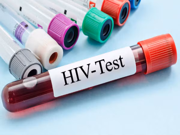 Virus giống HIV, nguy cơ lây sang người nguy hiểm sao? Virus giong HIV, nguy co lay sang nguoi nguy hiem sao?