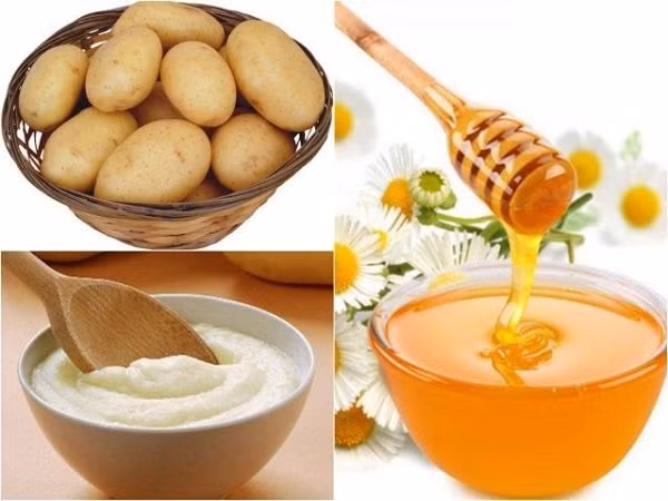 Sau đó, bạn thoa hỗn hợp này lên vùng mũi có mụn đầu đen trong 15 - 20 phút rồi rửa lại với nước sạch. Ảnh: agiadinh.