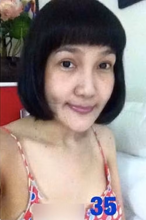 Sau quá trình chuyển giới trong nhiều năm, đến năm 35 tuổi, mỹ nhân này có dấu hiệu xuống sắc, khuôn mặt trở nên sần sùi, nhăn nheo.