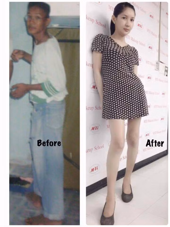 Hot girl chuyển giới U40 hiện tại có khuôn mặt thon gọn, làn da trắng mịn và đôi chân dài rất gợi cảm. Gây sốt trên mạng chưa lâu, nhân vật này bắt đầu tiết lộ những hình ảnh trong quá khứ, kể lại quá trình làm phẫu thuật thẩm mỹ chuyển giới của mình.