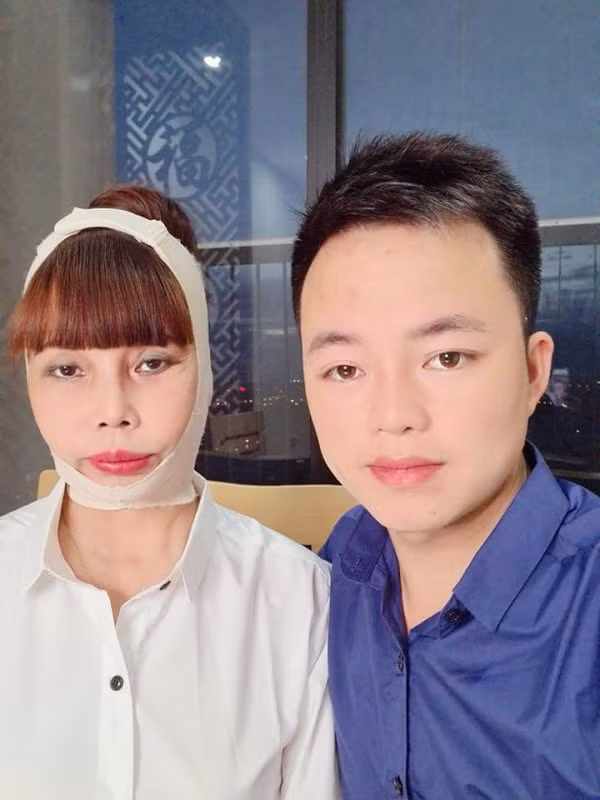 Khuôn mặt méo xệch, thiếu sức sống của cô dâu 62 Thu Sao trước khi tháo băng định hình.