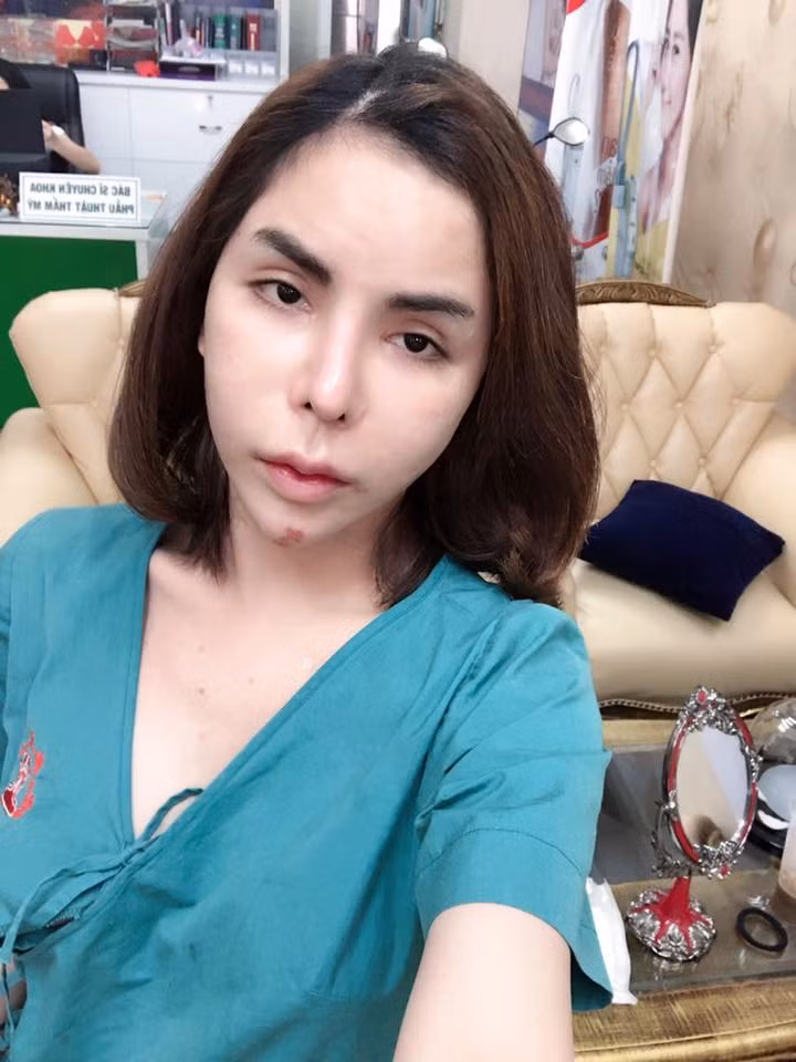 Linda cũng cho biết, tâm trạng của cô lúc này đang rất suy sụp. Dù những ngày qua đã có không ít người đã share trường hợp của cô bây giờ để cười cợt, nhưng Linda vẫn không để tâm và vẫn không ngại tiếp tục up tiếp tình trạng hiện giờ. Biết không còn cách cứu chữa nên Linda chỉ mong bình yên sẽ đến với mình về những ngày sau còn lại.