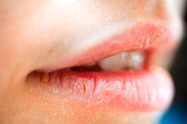 Trong khoang miệng của mỗi người tồn tại lượng vi khuẩn nhiều hơn cả số người trên Trái Đất.