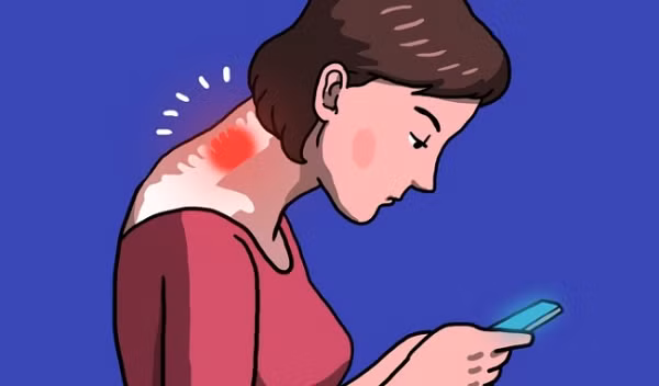 Mỗi người trung bình dành 2 - 4 tiếng nhìn vào màn hình điện thoại, điều này tương đương với 700-1400 giờ mỗi năm chúng ta tự tạo thêm áp lực cho cột sống. Tình trạng này kéo dài sẽ làm đau cơ cổ, nặng hơn bạn có thể bị đau dây thần kinh phía vai, lưng và cánh tay.