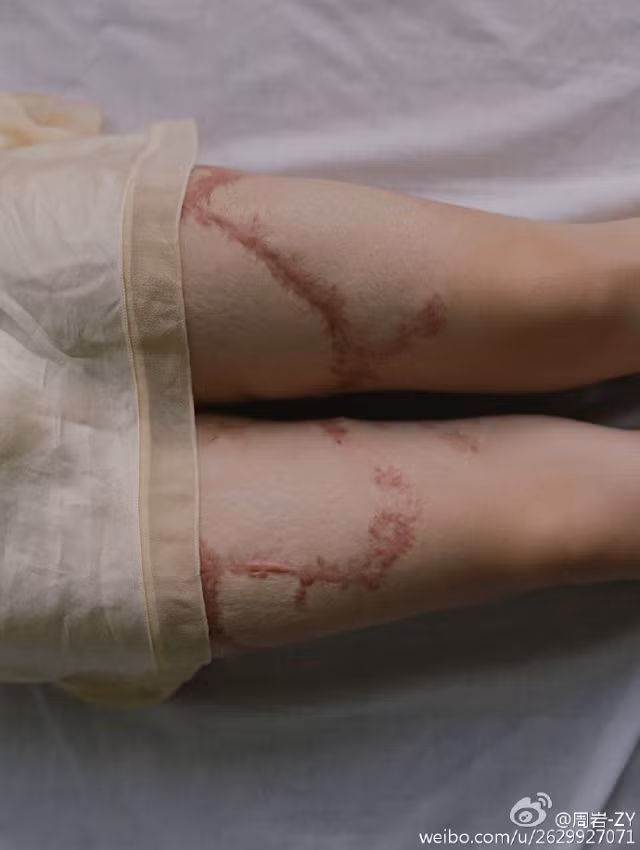 Gia đình Zhou vẫn quyết định kiện Tao ra tòa và cậu ta đã bị kết án 12 năm tù vào năm 2012. Họ cũng yêu cầu được bồi thường 4,67 triệu NDT (tương đương 16 tỷ đồng), nhưng tòa án sau đó chỉ chấp thuận mức bồi thường 1,72 triệu NDT.