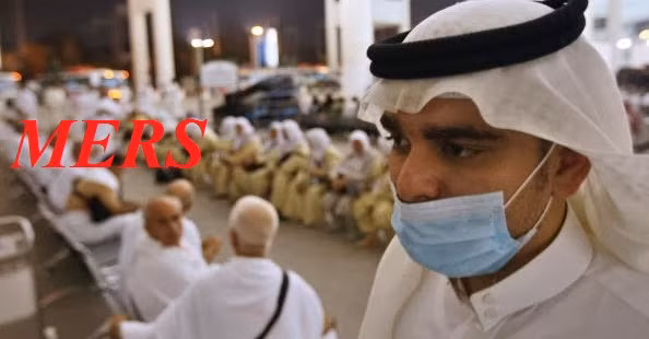 Virus MERS-CoV lây truyền từ người sang người và đã lan truyền ra nhiều quốc gia.