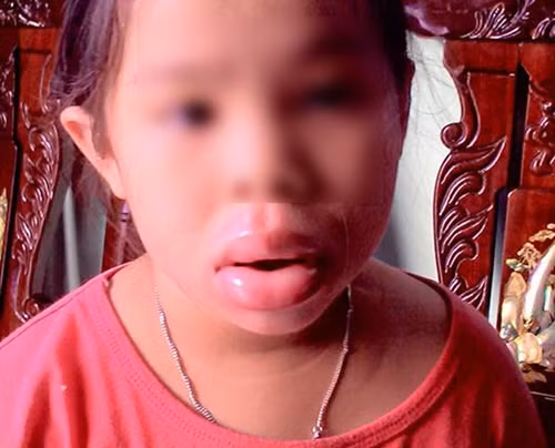 Moi sung vu, bien dang vi ngam do choi Trung Quoc