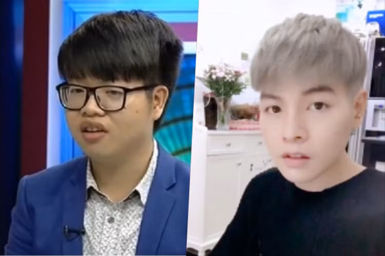 Đức Phúc phẫu thuật thẩm mỹ với mong muốn cảm thấy tự tin hơn. Sau hơn 1 tháng tuyên bố dao kéo, anh xuất hiện với gương mặt đẹp và khác hơn trước rất nhiều. Trước diện mạo mới của Đức Phúc hậu dao kéo, hầu hết các sao Việt đều bất ngờ. Ảnh: Dân Việt