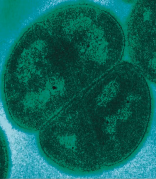 Một nhóm các nhà nghiên cứu Pháp và Croatia do Miroslav Radman thuộc Viện INSERM (Pháp) dẫn đầu đã phát hiện những giai đoạn của sự phục hồi này cho phép con vi khuẩn sống lại sau khi trải qua mức độ bức xạ cực mạnh.