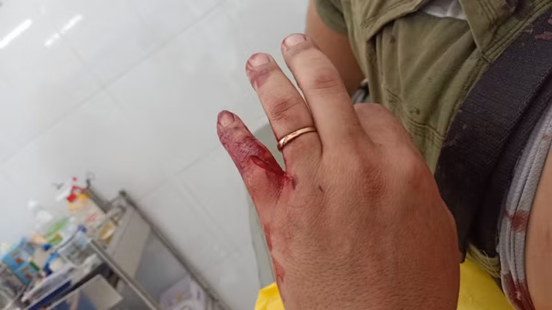  Bắn hạ khỉ hoang tấn công người: Chi cục Kiểm lâm TP. HCM phối hợp với lực lượng chức năng địa phương bắn hạ con khỉ hoang hung dữ tấn công gây thương tích cho một số người dân ở phường Thạnh Xuân quận 12. Con khỉ này đã tấn công và gây thương tích cho tổng cộng 5 người dân.