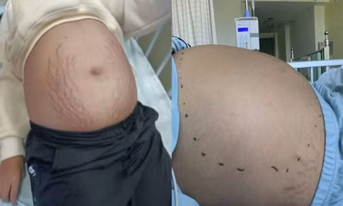 Tưởng bé gái 13 tuổi mang thai đôi, bác sĩ sốc khi biết sự thật Tuong be gai 13 tuoi mang thai doi, bac si soc khi biet su that