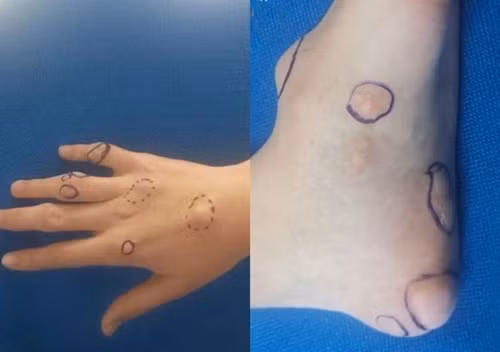 3 năm không uống nước lọc, cơ thể chàng trai trẻ thay đổi ghê rợn - Hình 2 3 nam khong uong nuoc loc, co the chang trai tre thay doi ghe ron-Hinh-2