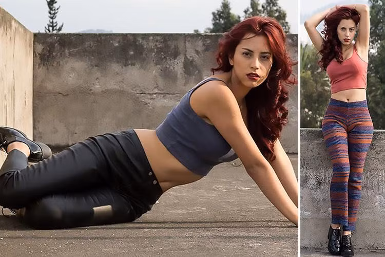 Số phận bi thảm của cô gái đầu tiên hút mỡ trong lịch sử - Hình 3 So phan bi tham cua co gai dau tien hut mo trong lich su-Hinh-3