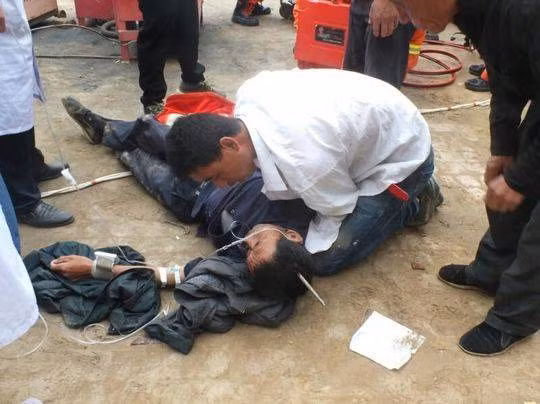 Chuyện lạ hôm nay: Kỳ tích, bị thanh thép xuyên qua đầu vẫn sống - Hình 2 Chuyen la hom nay: Ky tich, bi thanh thep xuyen qua dau van song-Hinh-2