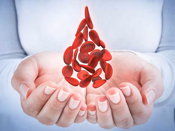 Thiếu máu có thể gây ra nhiều vấn đề như hoa mắt chóng mắt, tim đập nhanh, cơ thể mệt mỏi... Do vậy, chúng ta luôn cần bổ sung thêm các thực phẩm giàu chất sắt để giúp "bơm" máu vào cơ thể nhanh chóng. Ảnh: Boldsky.