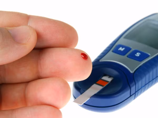 Giảm đường máu: Bột tỏi giúp tăng mức insulin trong máu một cách tự nhiên. Điều này khiến cho nó trở thành một phương thuốc lý tưởng đối với những người có lượng đường máu cao và có thể giúp bạn kiểm soát bệnh tiểu đường, do đó muối tỏi rất tốt cho bệnh nhân đái tháo đường. Ảnh: Boldsky.