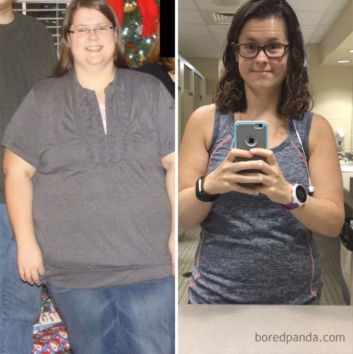 Cô gái này đã loại bỏ được 72kg mỡ thừa từ năm 2014. Ảnh: BP.