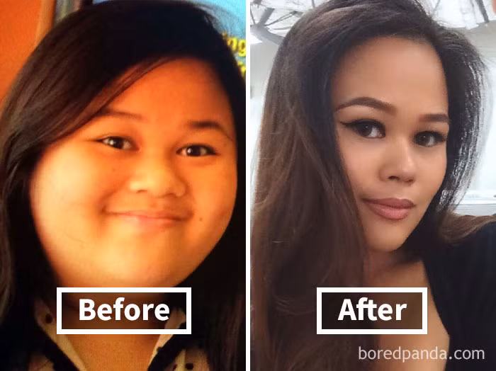 Khuôn mặt của cô ấy nhỏ nhắn và có điểm nhấn hơn nhờ giảm cân. Ảnh: Boredpanda.
